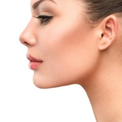 Rhinoplasty
